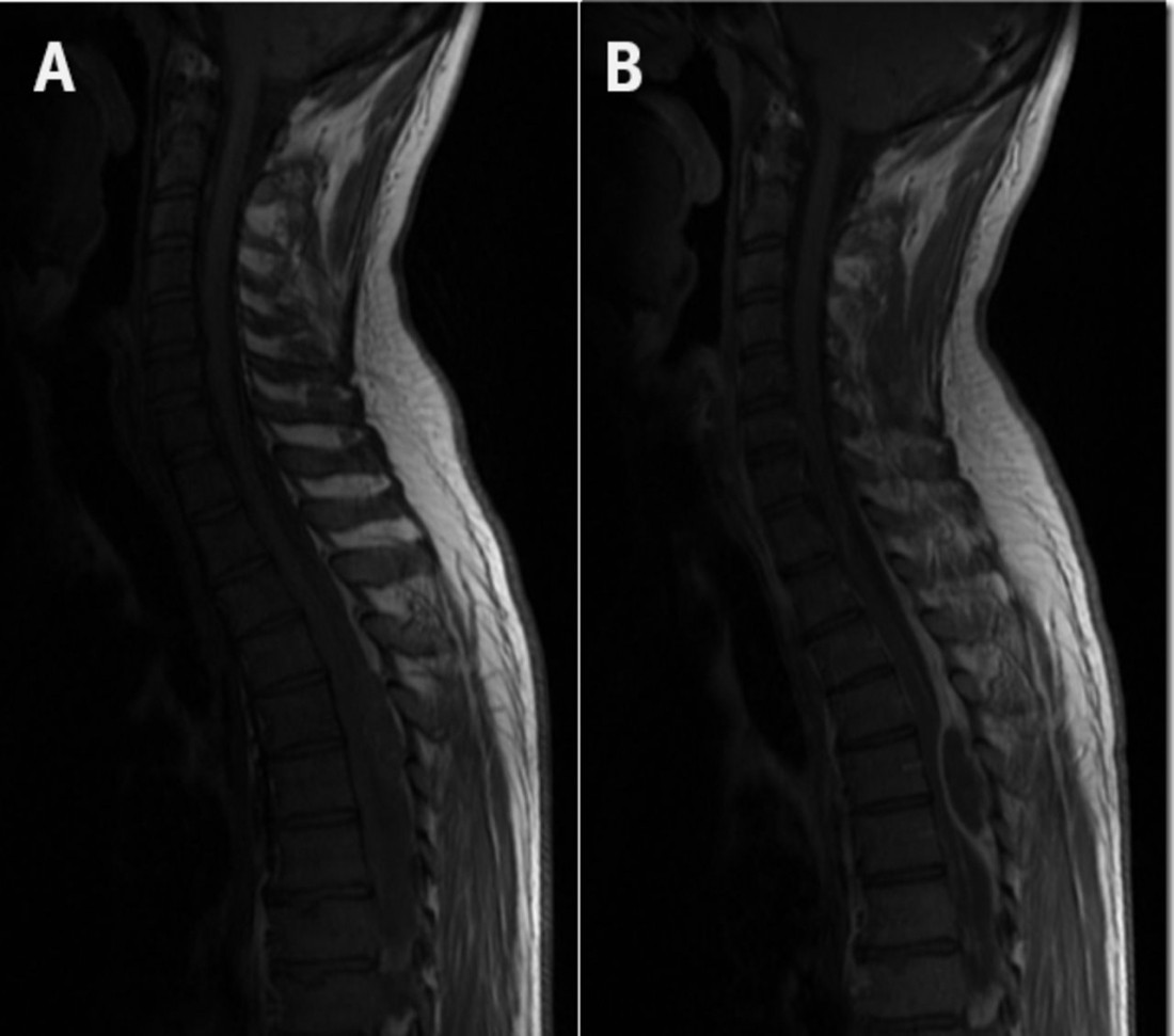 Болит спина потеря аппетита