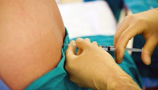 Эпидуральная анестезия Эпидуральная анестезия